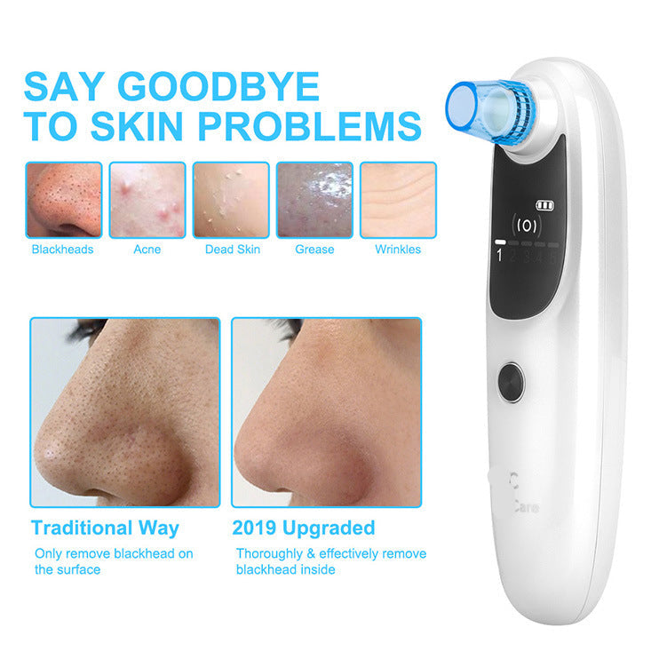 Blackhead Remover and Pore Cleaner